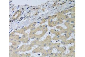 Immunohistochemistry (Paraffin-embedded Sections) (IHC (p)) image for anti-ATPase Family, AAA Domain Containing 3B (ATAD3B) antibody (ABIN7264303)