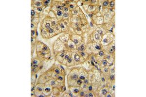 Immunohistochemistry (Paraffin-embedded Sections) (IHC (p)) image for anti-Adaptor-Related Protein Complex 2, alpha 2 Subunit (AP2A2) (AA 610-637) antibody (ABIN652491)