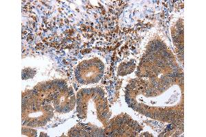 Immunohistochemistry (IHC) image for anti-Ciliary Neurotrophic Factor Receptor (CNTFR) (AA 190-340) antibody (ABIN6219761) (CNTF Receptor alpha Antikörper  (AA 190-340))