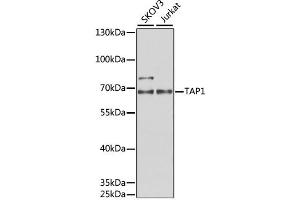 Western blot analysis of extracts of various cell lines, using TAP1 antibody (ABIN1882340) at 1:1000 dilution.