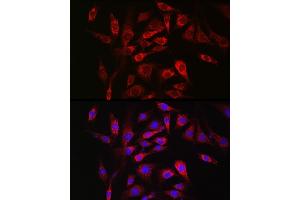 Immunofluorescence analysis of NIH/3T3 cells using SOCS3 Rabbit pAb (ABIN3015316, ABIN3015317, ABIN5663764 and ABIN6213984) at dilution of 1:50 (40x lens). (SOCS3 Antikörper  (C-Term))