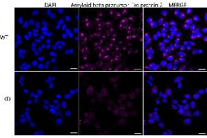 Immunocytochemical staining of HeLa cells using Amyloid beta precursor like protein 2 antibody (ABIN7797595), 1:1,000), Top panel: wild-type (WT), Bottom panal: Amyloid beta precursor like protein 2 shRNA knockdown (KD). (Rekombinanter APLP2 Antikörper)