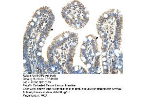 Rabbit Anti-NXF5 Antibody  Paraffin Embedded Tissue: Human Intestine Cellular Data: Epithelial cells of intestinal villas Antibody Concentration: 4. (NXF5 Antikörper  (Middle Region))