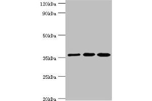 Western blot All lanes: Glutaredoxin-3 antibody at 10 μg/mL Lane 1: Rat brain tissue Lane 2: HepG2 whole cell lysate Lane 3: Hela whole cell lysate Secondary Goat polyclonal to rabbit IgG at 1/10000 dilution Predicted band size: 37 kDa Observed band size: 37 kDa (GLRX3 Antikörper  (AA 1-335))