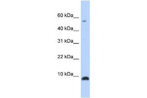 WB Suggested Anti-CXCL6 Antibody Titration: 0. (CXCL6 Antikörper  (Middle Region))