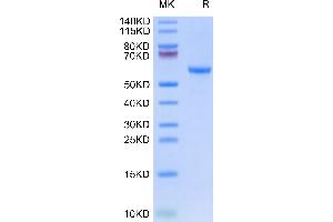 SDS-PAGE (SDS) image for HLA Class I Histocompatibility Antigen, alpha Chain G (HLAG) (AA 25-305), (Monomer) protein (His-Avi Tag,Peptide (RIIPRHLQL)) (ABIN7274820)
