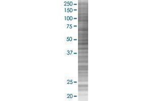 Western Blotting (WB) image for HSPB8 293T Cell Transient Overexpression Lysate(Denatured) (ABIN1335906)