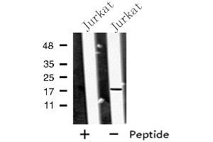 Western blot analysis of MED9 using Jurkat whole cell lysates