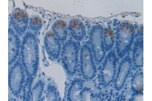 Immunohistochemistry (IHC) image for anti-HSPA Binding Protein, Cytoplasmic Cochaperone 1 (HSPBP1) (AA 198-352) antibody (ABIN7437581)