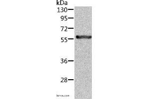 Western blot analysis of Rat kidney tissue, using ALDH6A1 Polyclonal Antibody at dilution of 1:450 (ALDH6A1 Antikörper)