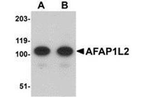 Western blot analysis of AFAP1L2 in mouse liver tissue lysate with AP30026PU-N AFAP1L2 antibody at (A) 1 and (B) 2 μg/ml.