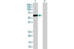 Lane 1: ZBTB8 transfected lysate ( 48. (ZBTB8 293T Cell Transient Overexpression Lysate(Denatured))