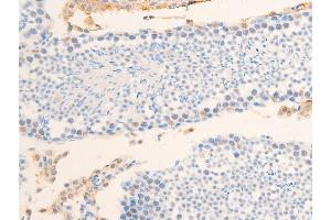 ABIN6267234 at 1/100 staining mouse testis tissue sections by IHC-P. (Survivin Antikörper  (pThr117))