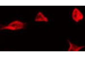 ABIN6266584 staining NIH-3T3 by IF/ICC. (MLANA Antikörper  (Internal Region))