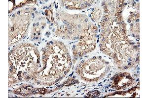 Immunohistochemical staining of paraffin-embedded Human Kidney tissue using anti-TUBAL3 mouse monoclonal antibody.