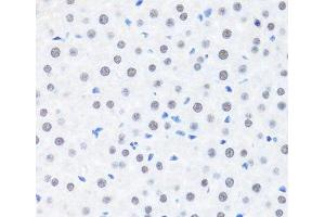 Immunohistochemistry of paraffin-embedded Rat liver using BRMS1 Polyclonal Antibody at dilution of 1:100 (40x lens). (BRMS1 Antikörper)