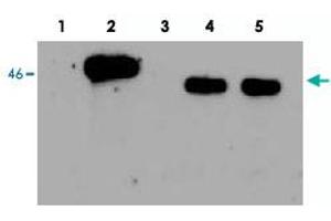 Western Blot analysis of human EGLN1, using EGLN1 polyclonal antibody . (EGLN1 Antikörper)