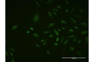 Immunofluorescence of monoclonal antibody to TFAP2A on HeLa cell. (TFAP2A Antikörper  (AA 99-205))