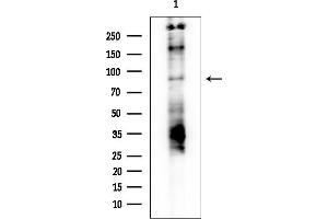 anti-Glycogen Synthase 1 (Muscle) (GYS1) (pSer645) antibody