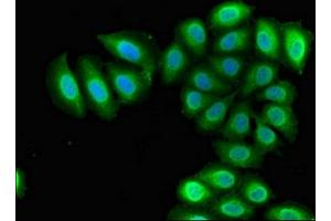 Immunofluorescent analysis of A549 cells using ABIN7168341 at dilution of 1:100 and Alexa Fluor 488-congugated AffiniPure Goat Anti-Rabbit IgG(H+L) (RBM38 Antikörper  (AA 1-239))