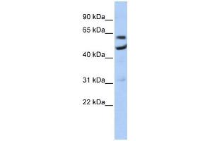 CNOT6 antibody used at 1 ug/ml to detect target protein.