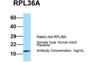 Host: Rabbit  Target Name: RPL36A  Sample Tissue: Human Adult Placenta  Antibody Dilution: 1. (RPL36AL Antikörper  (C-Term))