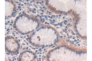 Immunohistochemistry (IHC) image for anti-P450 (Cytochrome) Oxidoreductase (POR) (AA 77-518) antibody (ABIN7435475)