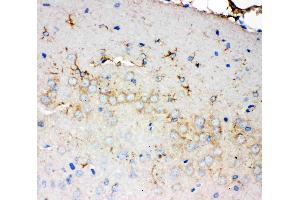 Anti-PMP70 antibody, IHC(P): Rat Brain Tissue (CX3CL1 Antikörper  (C-Term))