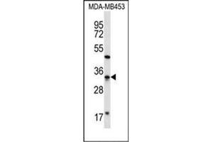 Western blot analysis of FTSJ1 Antibody (N-term) in MDA-MB453 cell line lysates (35ug/lane).