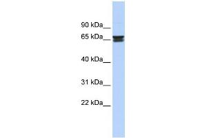 WB Suggested Anti-ZNF614 Antibody Titration:  0. (ZNF614 Antikörper  (Middle Region))