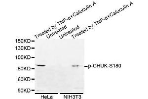 Western blot analysis of extracts of various cell lines, using Phospho-CHUK-S180 antibody (ABIN5995593). (IKK alpha Antikörper  (pSer180))