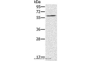 Western blot analysis of NIH/3T3 cell, using RELB Polyclonal Antibody at dilution of 1:200 (RELB Antikörper)