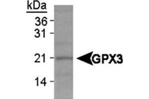 Western blot analysis of GPX3 on HeLa whole cell extracts using GPX3 polyclonal antibody .
