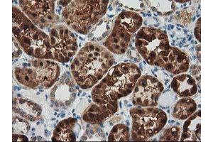 Immunohistochemical staining of paraffin-embedded Human Kidney tissue using anti-GRHPR mouse monoclonal antibody. (GRHPR Antikörper)