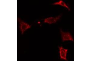 ABIN6274315 staining Hela cells by IF/ICC.