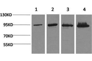 Western Blot analysis of 1) Hela, 2) 293T, 3) Mouse liver, 4) Rat liver with Catenin beta Monoclonal Antibody (beta Catenin Antikörper)