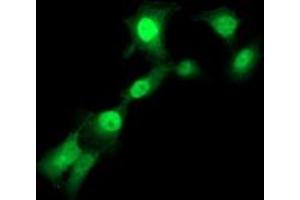 Anti-TMOD1 mouse monoclonal antibody (ABIN2454774) immunofluorescent staining of COS7 cells transiently transfected by pCMV6-ENTRY TMOD1 (RC201134). (Tropomodulin 1 Antikörper)
