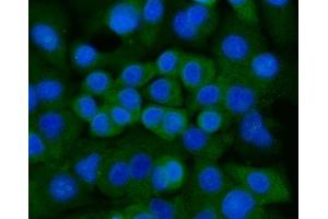 IF analysis of Ankyrin Erythroid/ANK/ANK1 using anti-Ankyrin Erythroid/ANK/ANK1 antibody (ABIN7599959). (Erythrocyte Ankyrin Antikörper  (AA 1300-1844))