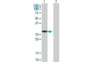 Western Blot analysis of KCNIP3 expression in transfected 293T cell line by KCNIP3 MaxPab polyclonal antibody.