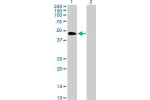 Western Blot analysis of VASP expression in transfected 293T cell line by VASP MaxPab polyclonal antibody.