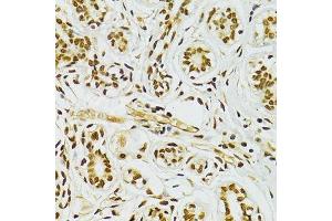 Immunohistochemistry (Paraffin-embedded Sections) (IHC (p)) image for anti-Adenosine Deaminase, RNA-Specific (ADAR) (AA 150-250) antibody (ABIN6136553)