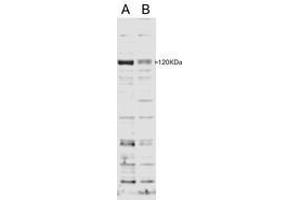 Image no. 1 for anti-SECIS Binding Protein 2 (SECISBP2) (AA 545-557) antibody (ABIN293116) (SECISBP2 Antikörper  (AA 545-557))