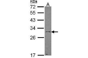 WB Image Sample (30 ug of whole cell lysate) A: Hep G2 , 12% SDS PAGE antibody diluted at 1:500 (Ephrin A3 Antikörper)