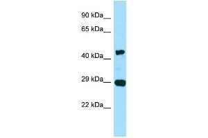 WB Suggested Anti-ACTG2 Antibody Titration: 0. (ACTG2 Antikörper  (C-Term))