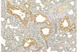 ABIN6263233 and ABIN6272850 at 1/100 staining Rat lung tissue by IHC-P.