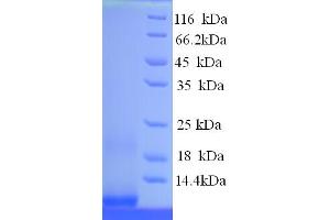 SDS-PAGE (SDS) image for HIRV1 (AA 1-65), (full length) protein (His tag) (ABIN5714236) (HIRV1 (AA 1-65), (full length) protein (His tag))