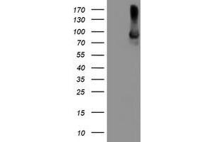 Western Blotting (WB) image for anti-Arachidonate 15-Lipoxygenase (ALOX15) antibody (ABIN1496358) (ALOX15 Antikörper)