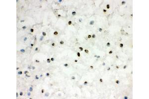 IHC analysis of EWSR1 using anti-EWSR1 antibody (ABIN3043825).