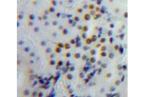 Used in DAB staining on fromalin fixed paraffin-embedded Kidney tissue (TOP2B Antikörper  (AA 446-655))