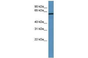 WB Suggested Anti-MAGED2 Antibody Titration: 0. (MAGED2 Antikörper  (N-Term))